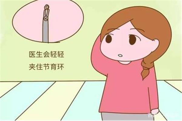 我可以在戒了一天毒后取下戒指吗?取下戒指会痛吗?大约需要几分钟